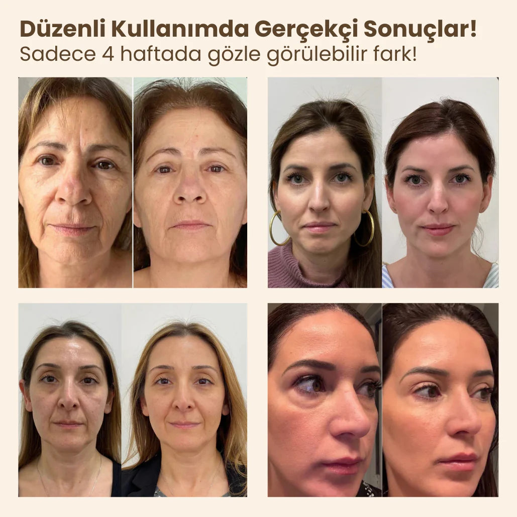 Liftvera™ Yüz Gerdirme Fırçası